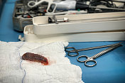 手术室里所有的设备。切除胆囊。