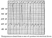 19世纪Quartan疟疾患者体温表