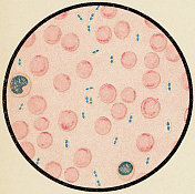 带肺炎球菌的小鼠血细胞显微镜观察，革兰氏染色法- 19世纪