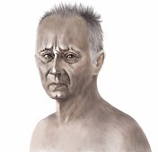 插图油画肖像的一个人在一个疾病的悲伤和悲伤在一个白色的背景
