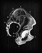 人体解剖骨骼的古董插图:骨盆