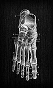 人体解剖骨骼古玩插图:踝骨、足骨