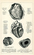 人类心脏医学插图1898年