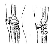 古董插图:人膝(左)和马膝(右)