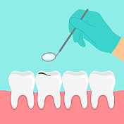 牙医手持角度镜检查牙齿。蛀牙。牙齿健康概念