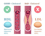 血液中胆固醇的种类。高密度脂蛋白(HDL)和低密度脂蛋白(LDL)。